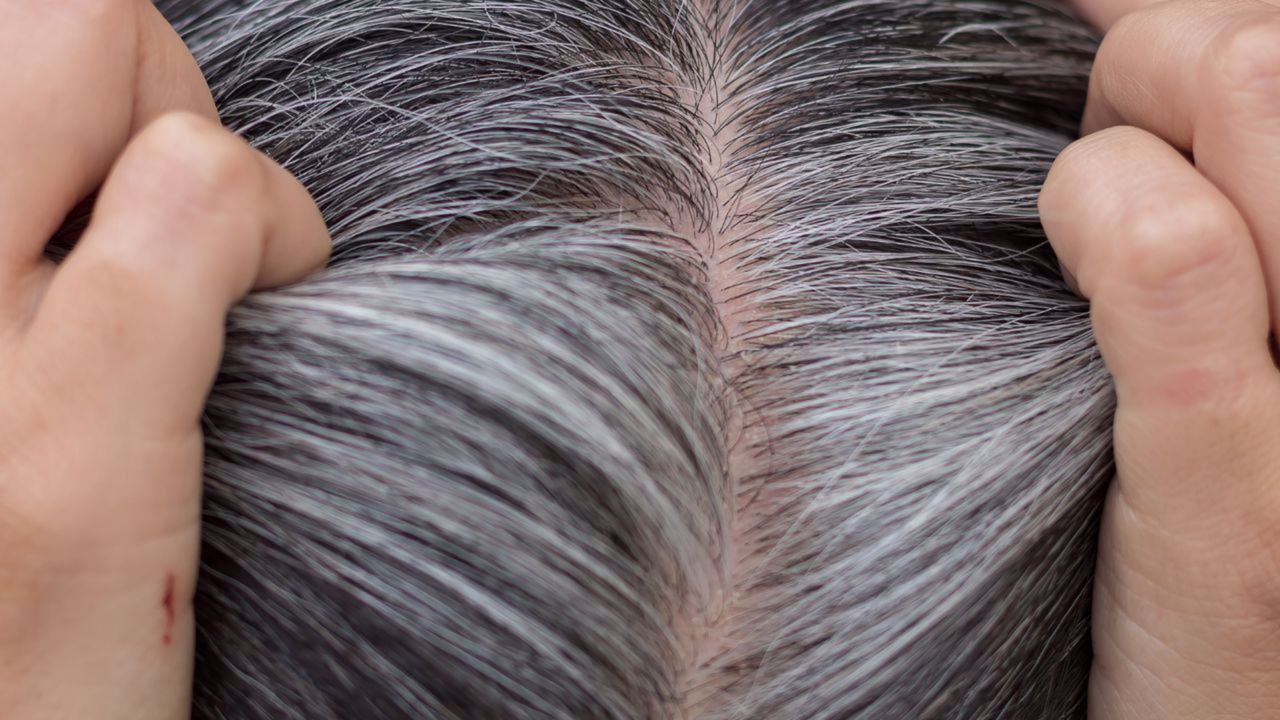 Porque é que o cabelo fica branco? Veja aqui como desacelerar o seu aparecimento.