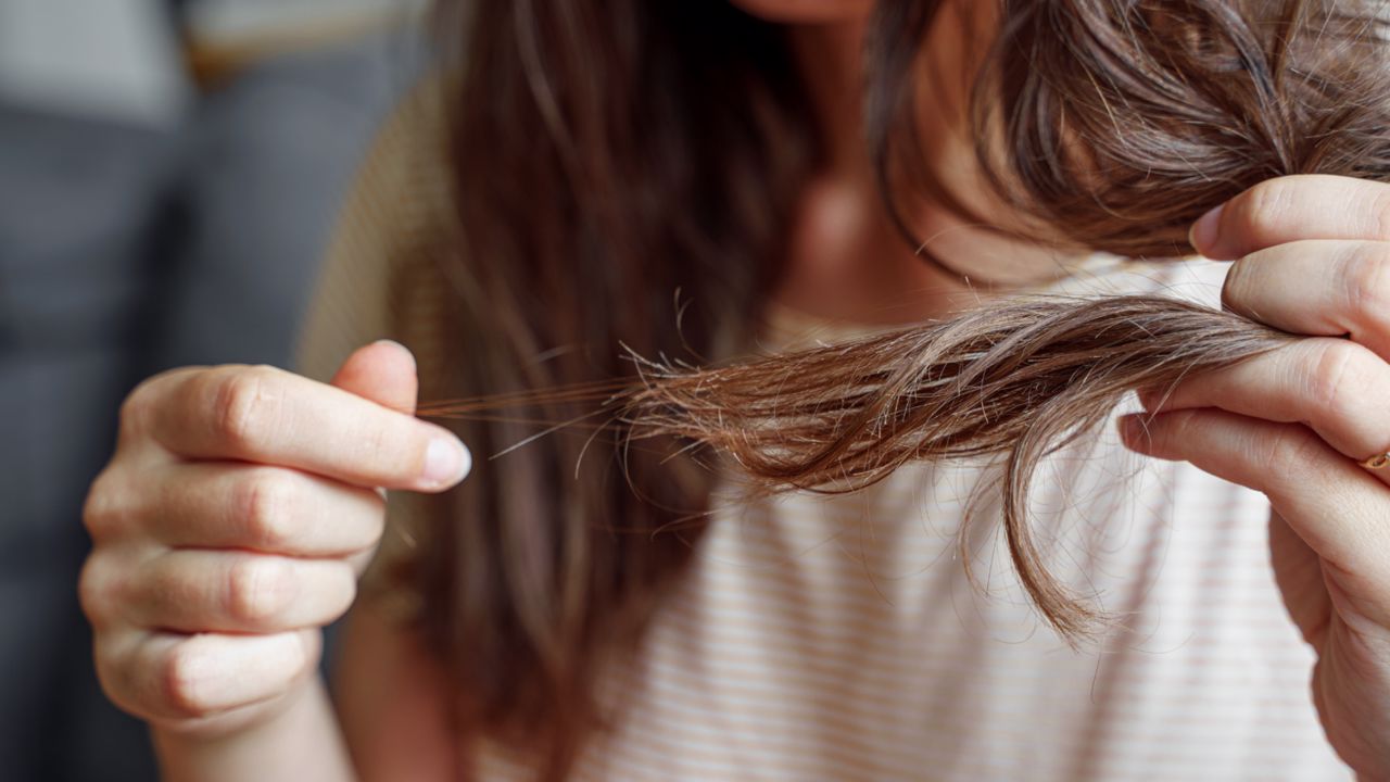 Queda de cabelo após a gravidez? Porque acontece e os remédios naturais