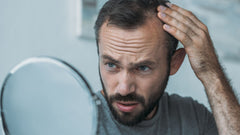 Alopecia masculina: causas, tipos e como prevenir a queda de cabelo com Haar Forte Gold Pro Man