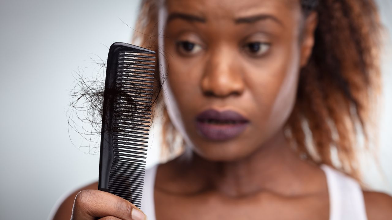 Queda de cabelo depois da Covid-19: os casos aumentam, porque é que isso acontece?